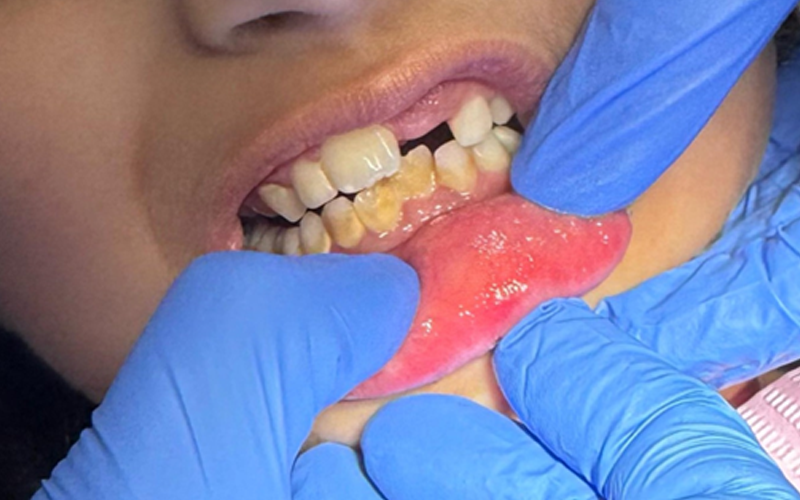 How To Brush Your Teeth Properly: A Simple Guide for a Healthy Smile