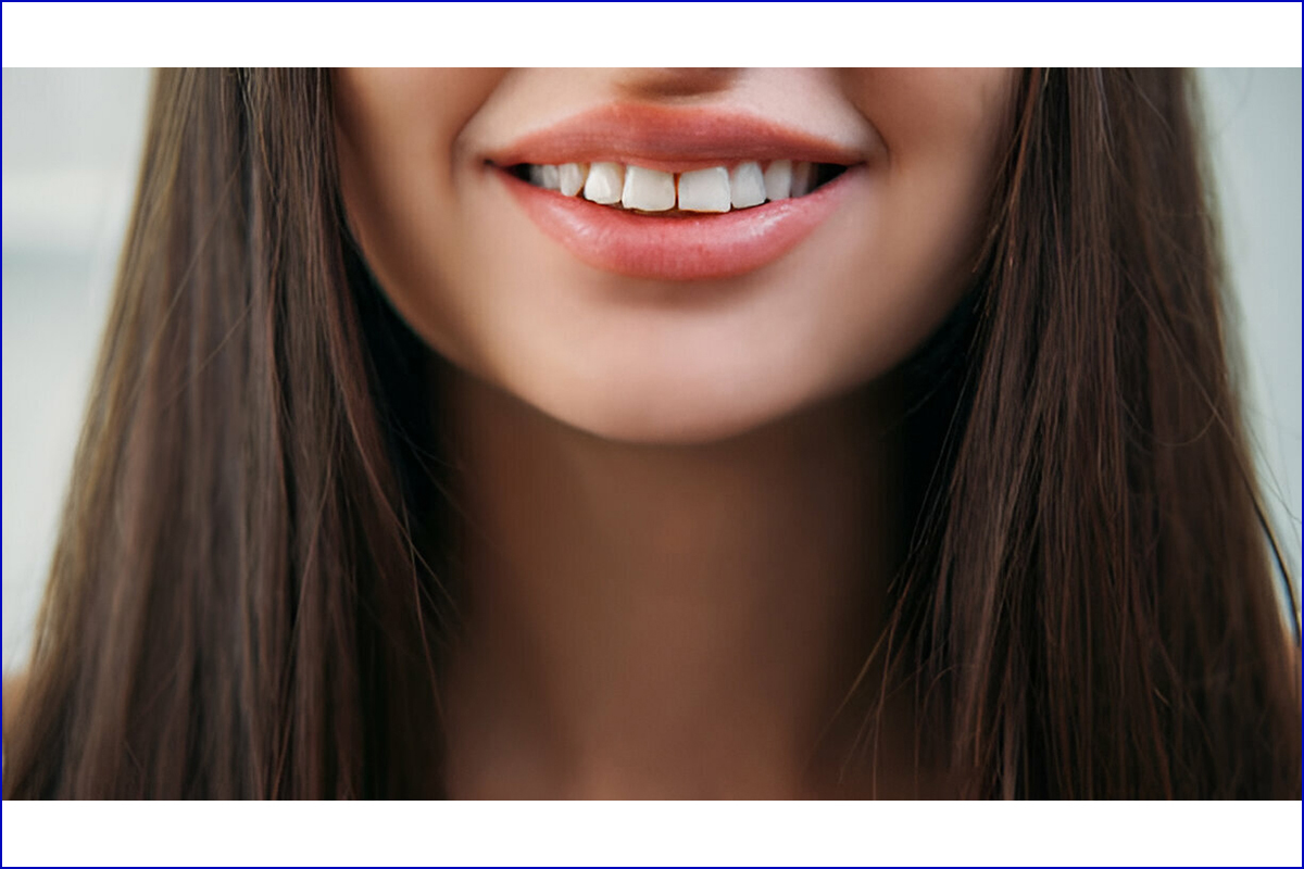 Best Dental Clinic for Smile Designing in Shela