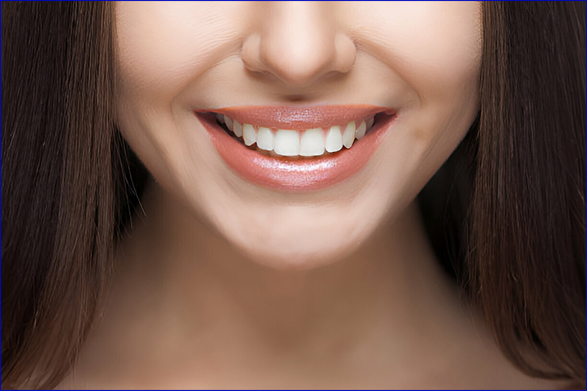 Best Dental Clinic for Smile Designing in Shela