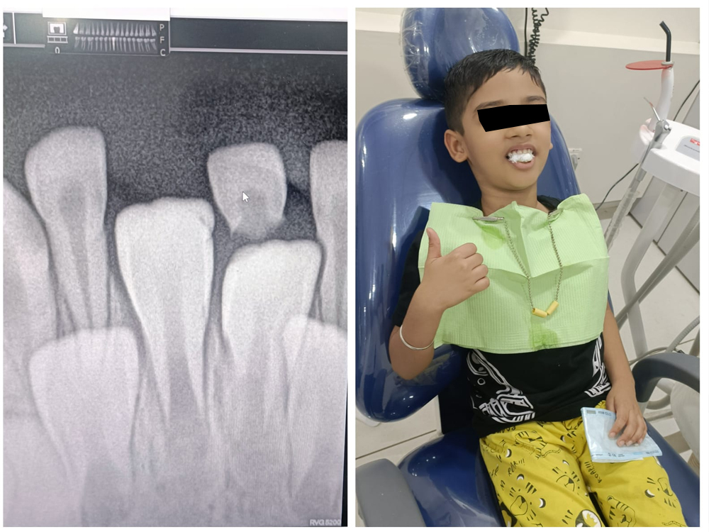 Best Dental Clinic in Shela - Bopal